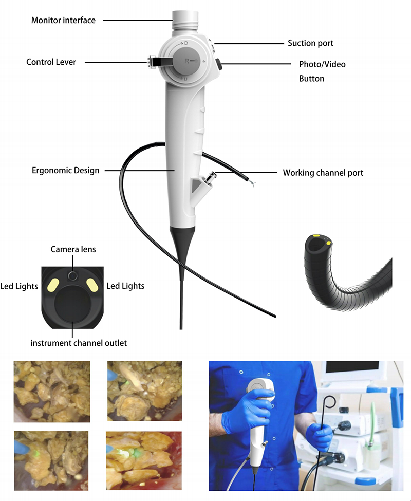 Reusable Digital Flexible Ureteroscope RK-VL-12