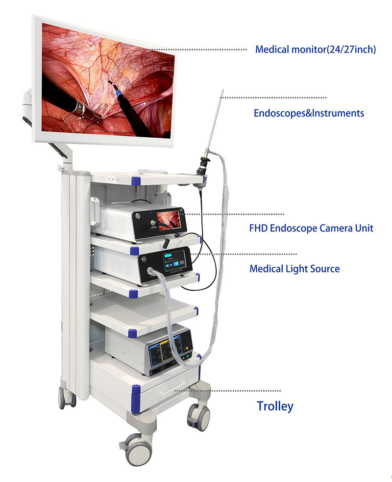 Fhd Endoscope Camera
