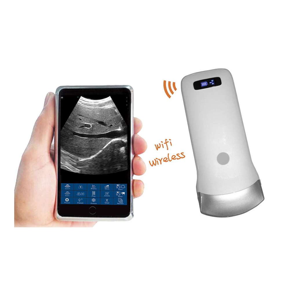 Ultrasound Scanner RK-5C